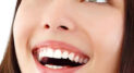 Private: Who Could Benefit from Dental Veneers?
