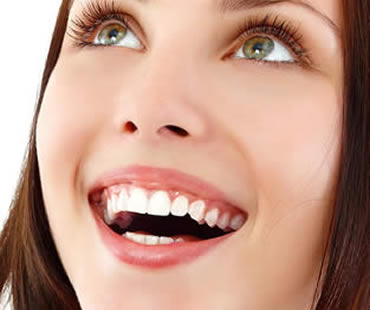 Private: Who Could Benefit from Dental Veneers?